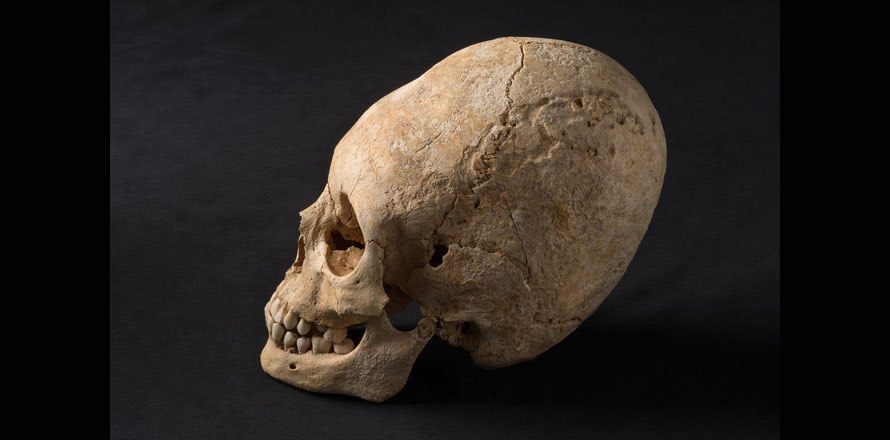 Elongated Skull France
